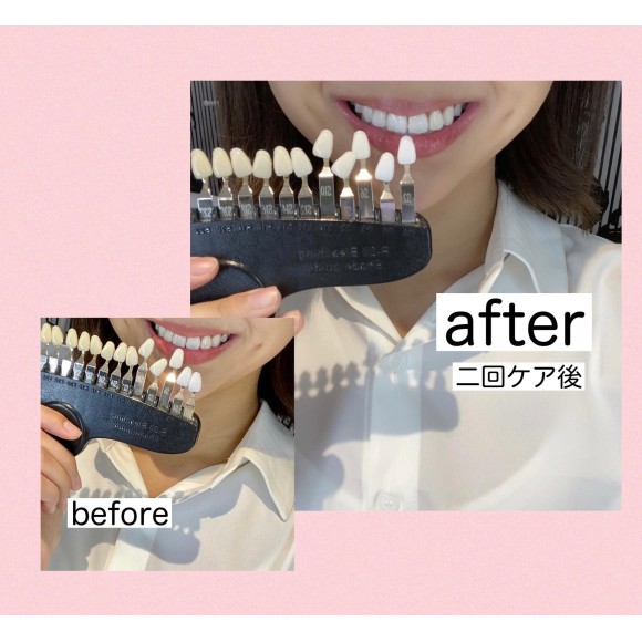 before after☆