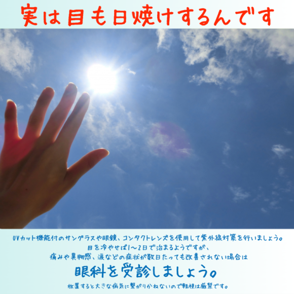 眼睛也要防紫外線!