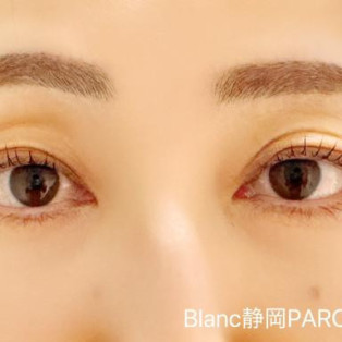 秋冬はケアが大事!