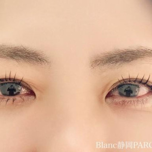 【マツパ】しっかり盛れる☆