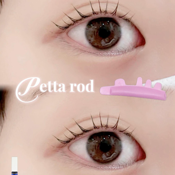 自然派さんから人気の【ペッタロッド】